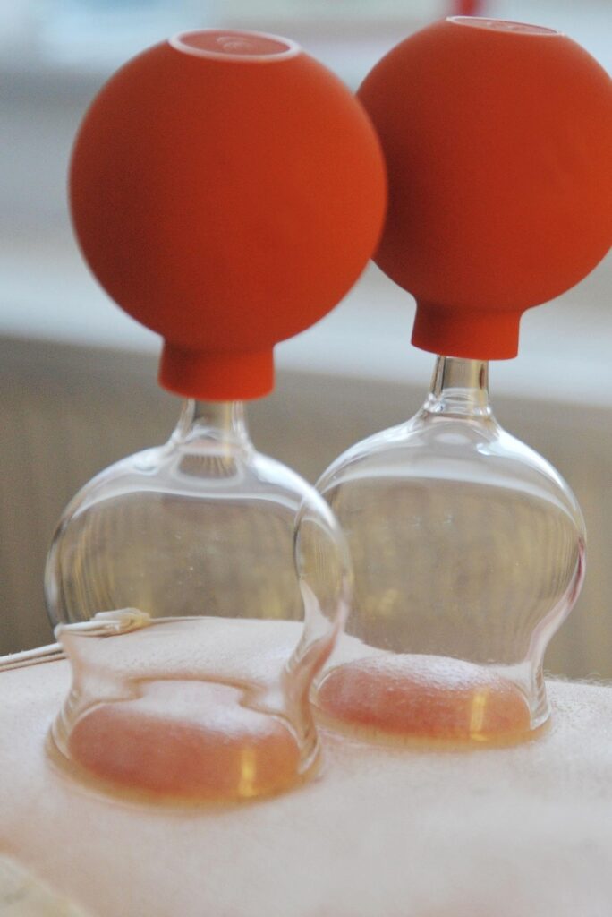 Cupping massage bij Solanya Massage in Spijkenisse